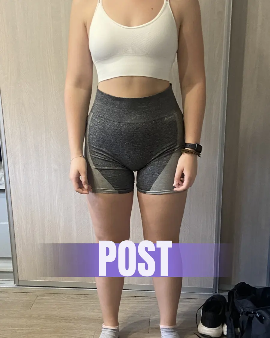 Andrea después de su proceso